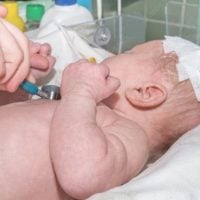 newborn receives treatment after birth injury
