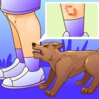 vector illustration of dog biting leg